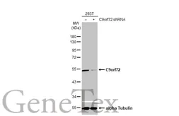 Anti-C9orf72 antibody [GT1553-RB] used in Western Blot (WB). GTX635398