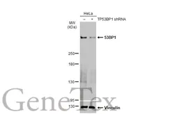 Anti-53BP1 antibody [HL275] used in Western Blot (WB). GTX635479