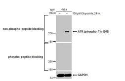 Anti-ATR (phospho Thr1989) antibody [HL132] used in Western Blot (WB). GTX635571