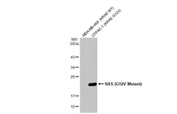 Anti-RAS (G12V Mutant) antibody [HL169] used in Western Blot (WB). GTX635623