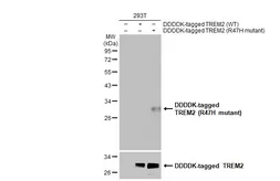 Anti-TREM2 (R47H Mutant) antibody [HL1032] used in Western Blot (WB). GTX635872
