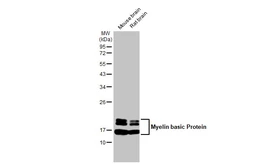 Anti-Myelin basic protein antibody [HL1033] used in Western Blot (WB). GTX635873