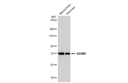 Anti-SARM1 antibody [HL1070] used in Western Blot (WB). GTX636102