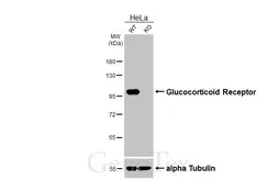 Anti-Glucocorticoid Receptor antibody [HL1151] used in Western Blot (WB). GTX636422