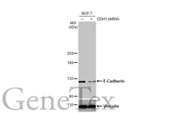 Anti-E-Cadherin antibody [HL1229] used in Western Blot (WB). GTX636577