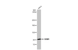 Anti-RRM1 antibody [HL1230] used in Western Blot (WB). GTX636578