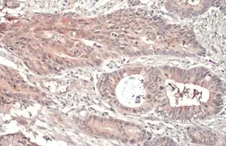 Anti-RRM1 antibody [HL1231] used in IHC (Paraffin sections) (IHC-P). GTX636579