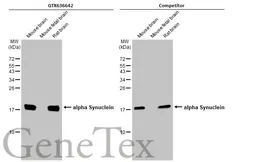 用于Western Blot（WB）的抗α-突触核蛋白抗体[HL1243]。GTX636642型