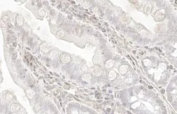 Anti-Transgelin antibody [HL1270] used in IHC (Paraffin sections) (IHC-P). GTX636672