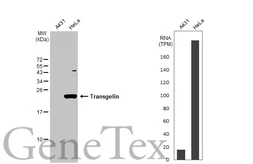 Anti-Transgelin antibody [HL1270] used in Western Blot (WB). GTX636672