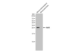 Anti-StAR antibody [HL1362] used in Western Blot (WB). GTX636802