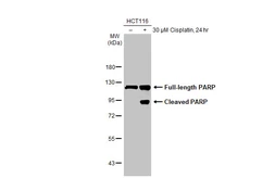 Anti-PARP antibody [HL1364] used in Western Blot (WB). GTX636804