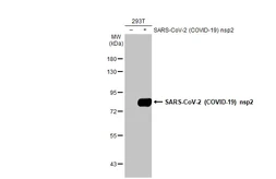Anti-SARS-CoV-2 (COVID-19) nsp2 antibody [HL1371] used in Western Blot (WB). GTX636811