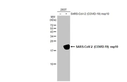 Anti-SARS-CoV-2 (COVID-19) nsp10 antibody [HL1379] used in Western Blot (WB). GTX636819
