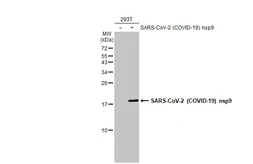 Anti-SARS-CoV-2 (COVID-19) nsp9 antibody [HL1399] used in Western Blot (WB). GTX636839