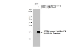 Anti-SARS-CoV-2 (COVID-19) Envelope antibody [HL1443] used in Western Blot (WB). GTX636915