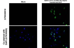 Anti-SARS-CoV-2 (COVID-19) nsp12 / RdRP antibody [HL1444] used in IHC-P (cell pellet) (IHC-P (cell pellet)). GTX636916