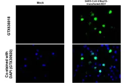 Anti-SARS-CoV-2 (COVID-19) nsp15 antibody [HL1446] used in IHC-P (cell pellet) (IHC-P (cell pellet)). GTX636918