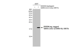 Anti-SARS-CoV-2 (COVID-19) ORF7b antibody [HL1453] used in Western Blot (WB). GTX636925