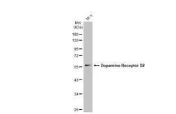 Anti-Dopamine Receptor D2 antibody [HL1478] used in Western Blot (WB). GTX636952