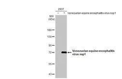 Anti-Venezuelan Equine Encephalitis Virus nsP1 antibody [HL1593] used in Western Blot (WB). GTX637072