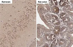 Anti-ROCK1 + ROCK2 antibody [HL1632] used in IHC (Paraffin sections) (IHC-P). GTX637125