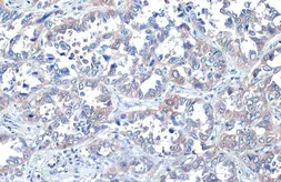 Anti-ROCK1 + ROCK2 antibody [HL1632] used in IHC (Paraffin sections) (IHC-P). GTX637125