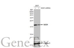 Anti-SOD1 antibody [HL1653] used in Western Blot (WB). GTX637251