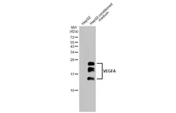 Anti-VEGFA antibody [HL1755] used in Western Blot (WB). GTX637405