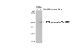 Anti-ATR (phospho Thr1989) antibody [HL1836] used in Western Blot (WB). GTX637561
