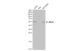 Anti-MLKL antibody [HL1849] used in Western Blot (WB). GTX637574