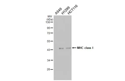 Anti-HLA class I antibody [HL1882] used in Western Blot (WB). GTX637631