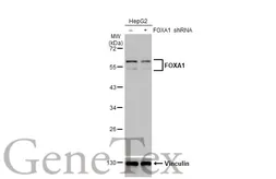 Anti-FOXA1 antibody [HL1975] used in Western Blot (WB). GTX637868