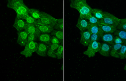 Anti-ELAVL2 antibody [HL1978] used in Immunocytochemistry/ Immunofluorescence (ICC/IF). GTX637871
