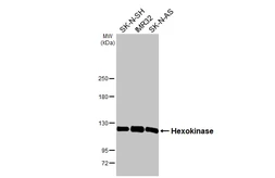 Anti-Hexokinase II antibody [HL2000] used in Western Blot (WB). GTX637901