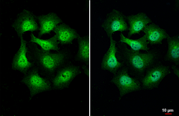 Anti-PIP5K1A antibody [HL2011] used in Immunocytochemistry/ Immunofluorescence (ICC/IF). GTX637912