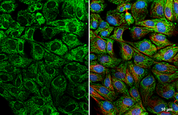 Anti-Bcl-XL antibody [HL2038] used in Immunocytochemistry/ Immunofluorescence (ICC/IF). GTX637939