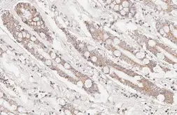 Anti-Bcl-XL antibody [HL2039] used in IHC (Paraffin sections) (IHC-P). GTX637940