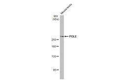 Anti-POLE antibody [HL2150] used in Western Blot (WB). GTX638128