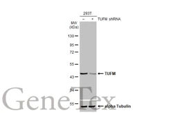 Anti-TUFM antibody [HL2193] used in Western Blot (WB). GTX638197