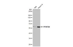 Anti-PFKFB4 antibody [HL2204] used in Western Blot (WB). GTX638208