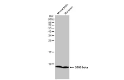 Anti-S100 beta antibody [HL2228] used in Western Blot (WB). GTX638273
