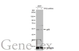 Anti-p53 antibody [HL2242] used in Western Blot (WB). GTX638291