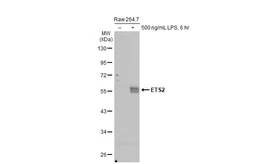Anti-ETS2 antibody [HL2259] used in Western Blot (WB). GTX638311