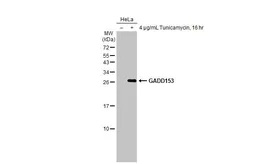 Anti-GADD153 antibody [HL2262] used in Western Blot (WB). GTX638314