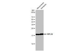 Anti-RPL32 antibody [HL2329] used in Western Blot (WB). GTX638492