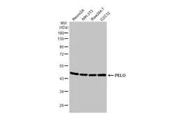 Anti-PELO antibody [HL2345] used in Western Blot (WB). GTX638548