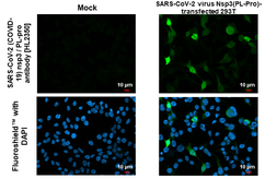 Anti-SARS-CoV-2 (COVID-19) nsp3 / PL-pro antibody [HL2350] used in Immunocytochemistry/ Immunofluorescence (ICC/IF). GTX638553