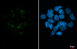 Anti-Coilin antibody [HL2384] used in Immunocytochemistry/ Immunofluorescence (ICC/IF). GTX638593