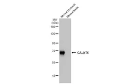 Anti-GALNT6 antibody [HL2392] used in Western Blot (WB). GTX638601